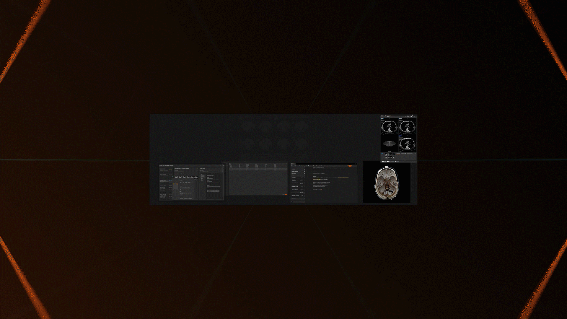 Syngo Carbon Space Teaser