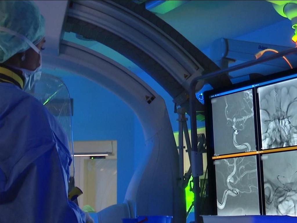 A doctor in the operating room performing a thrombectomy.