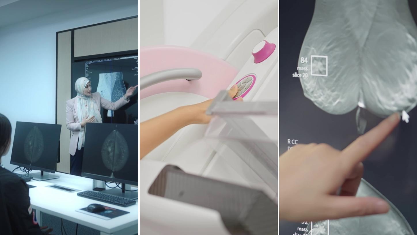 Klinische Bilder, die Scans, Brustkrebs-Screening-Bilder und Personen zeigen, die auf Dinge zeigen.