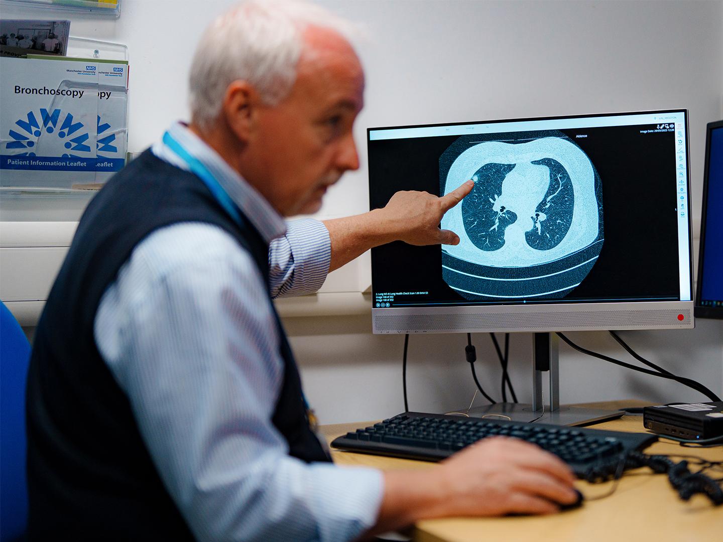 Lungcancer detection