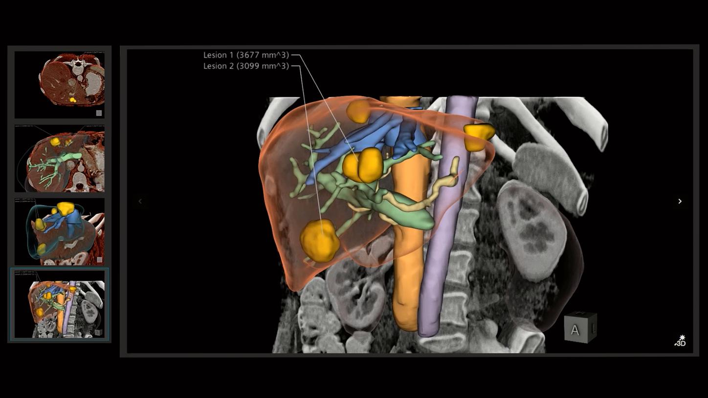 To visualize healthcare data, Kaloian Petkov uses 3D data visualization, which borrows techniques from other fields such as computer graphics and even the entertainment industry, as well as design and manufacturing. 