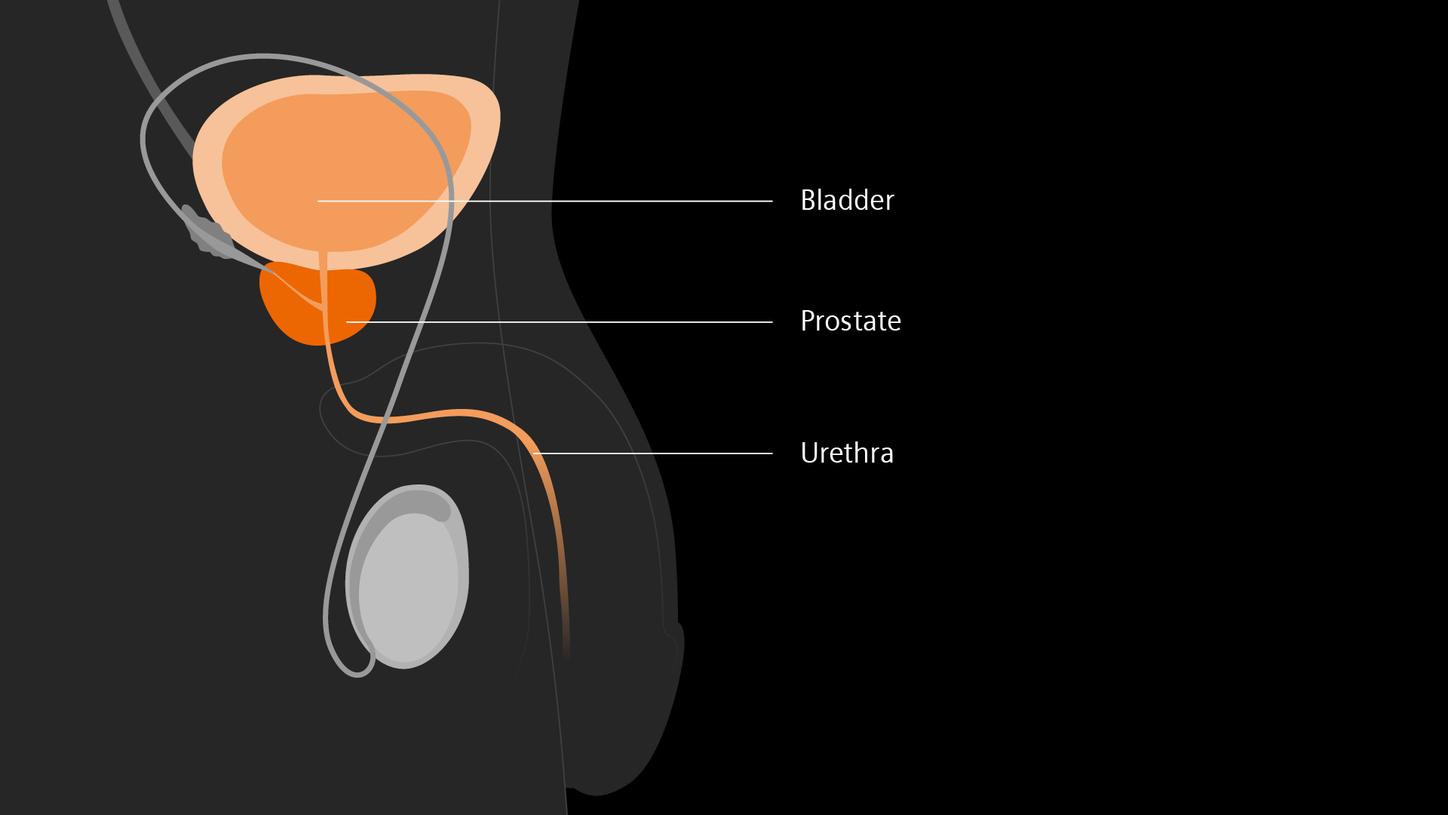 Visualization of the bladder, prostate and urethra