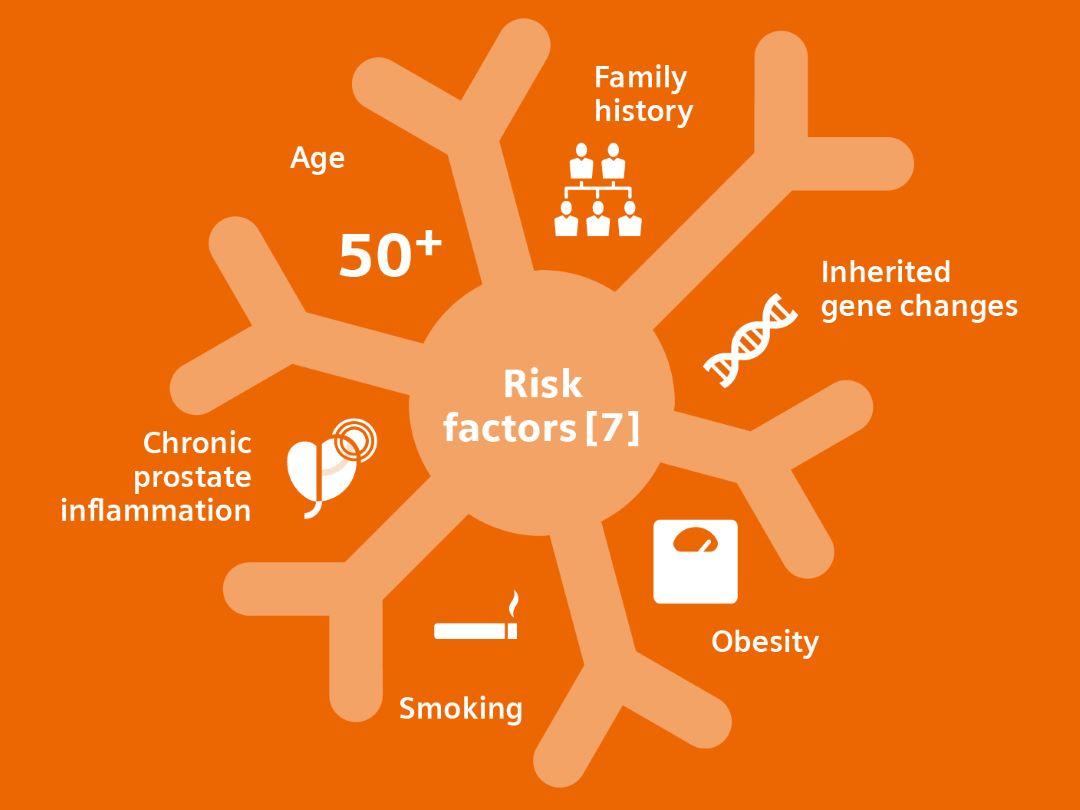 Risk factors for prostate cancer: Age, Family history, Inherited gene changes, Obesity, Smoking and Chronic prostate inflammation