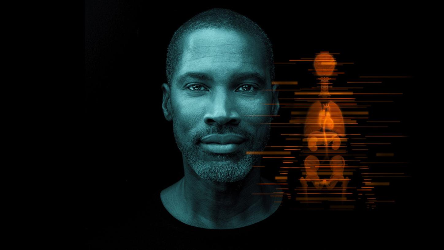 teaser: AI-Rad Companion Trial 