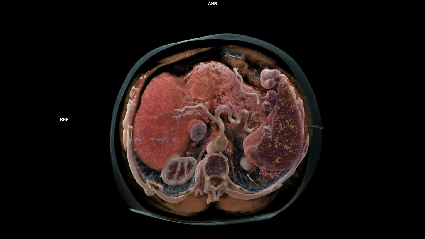 Diagnosis & Therapy Decision