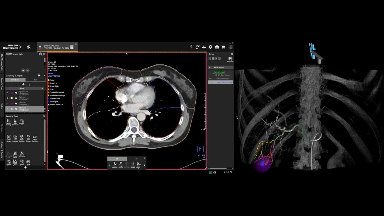 Follow-up & Survivorship