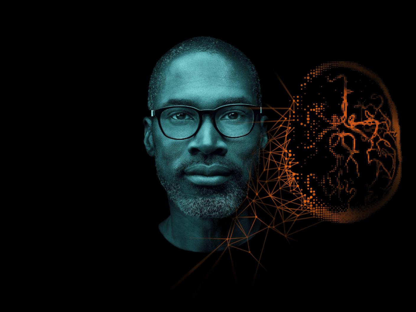 Options and upgrades for syngo.via