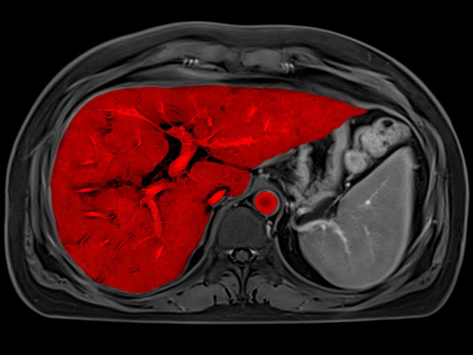 MRI - Clinical Specialities - Body MRI