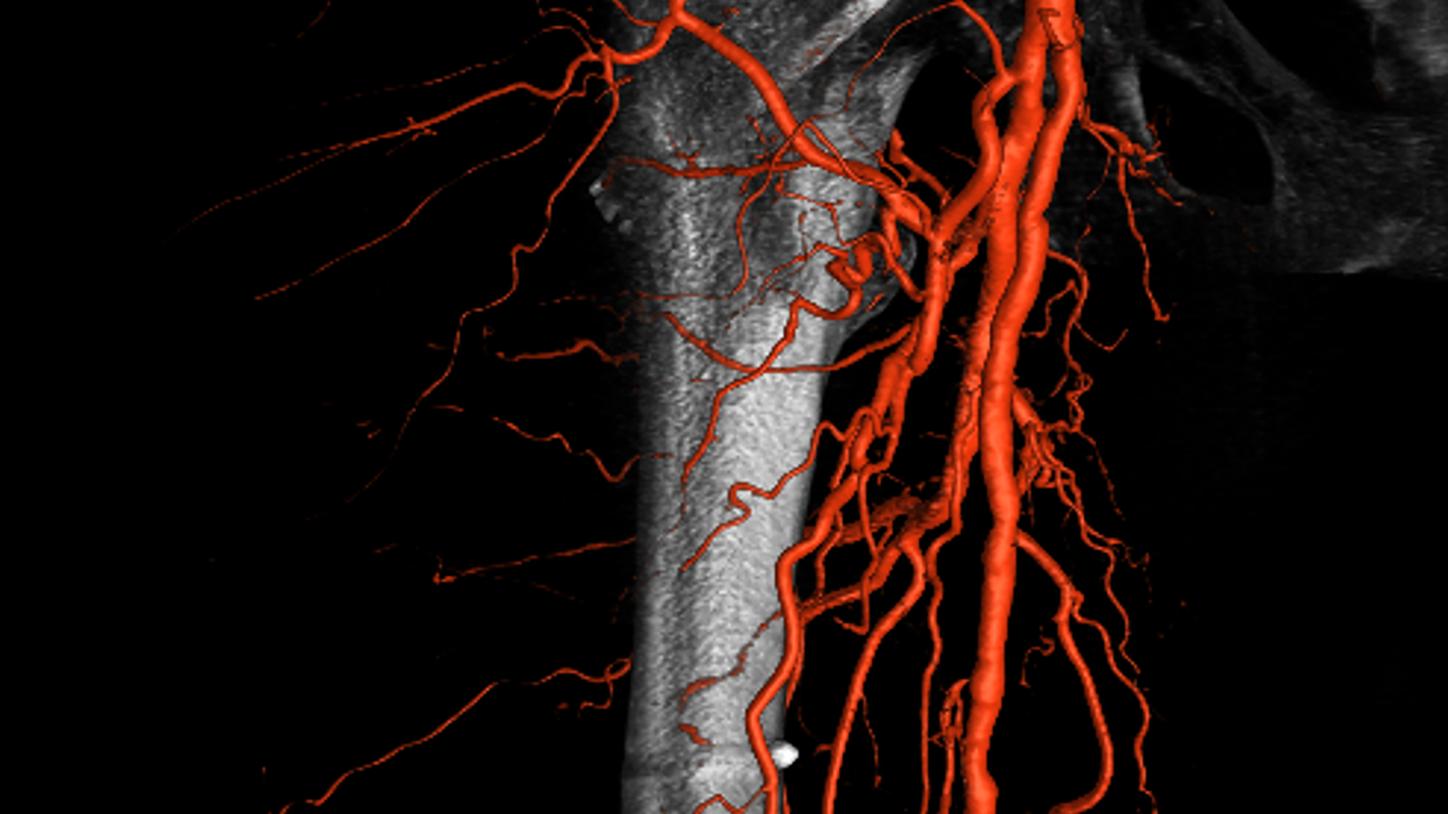 Interventional radiology equipment for peripheral and vascular interventions