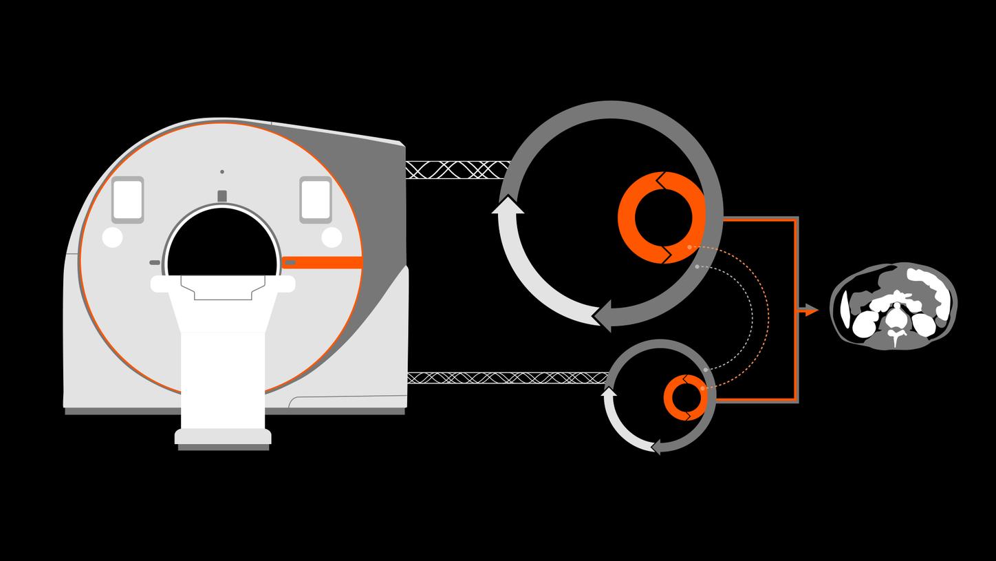 Illustration of the Quantum Iterative Reconstruction. The scanner on the left: two iterative reconstruction circles in the middle: a big one for high energy data stream, a small one for low energy data stream. The result on the right: an optimal clinical image with reduced noise levels.