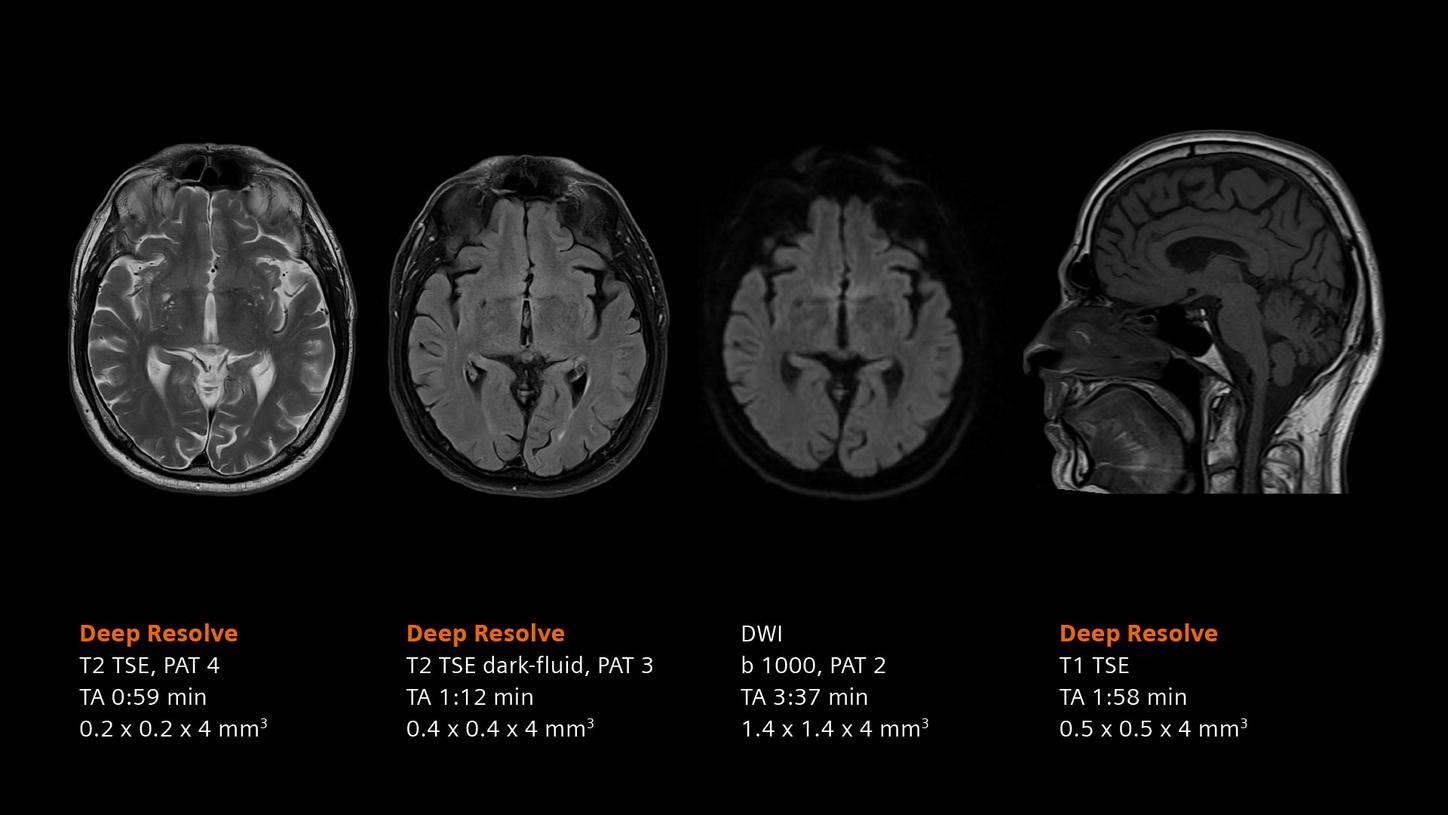 Clinical image - Head