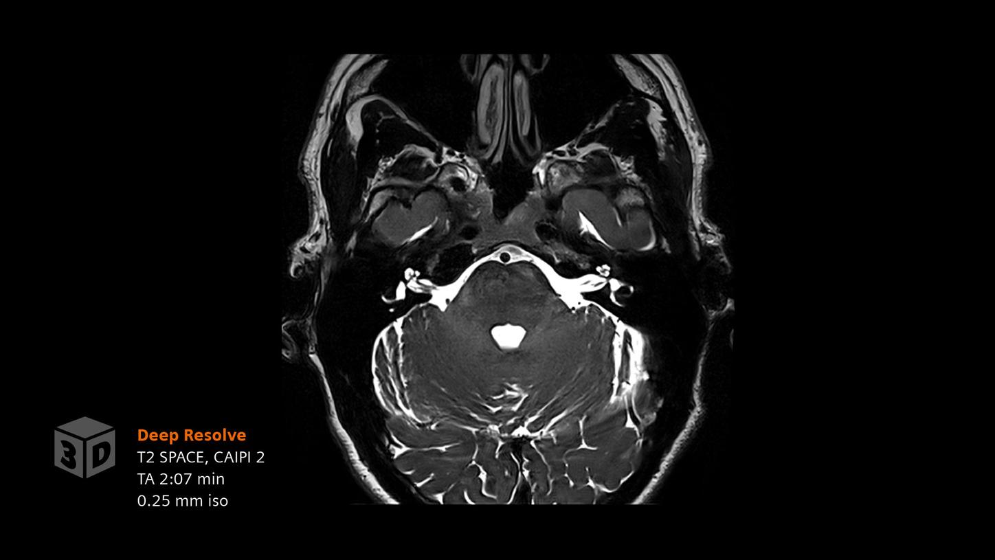 Clinical image - Head