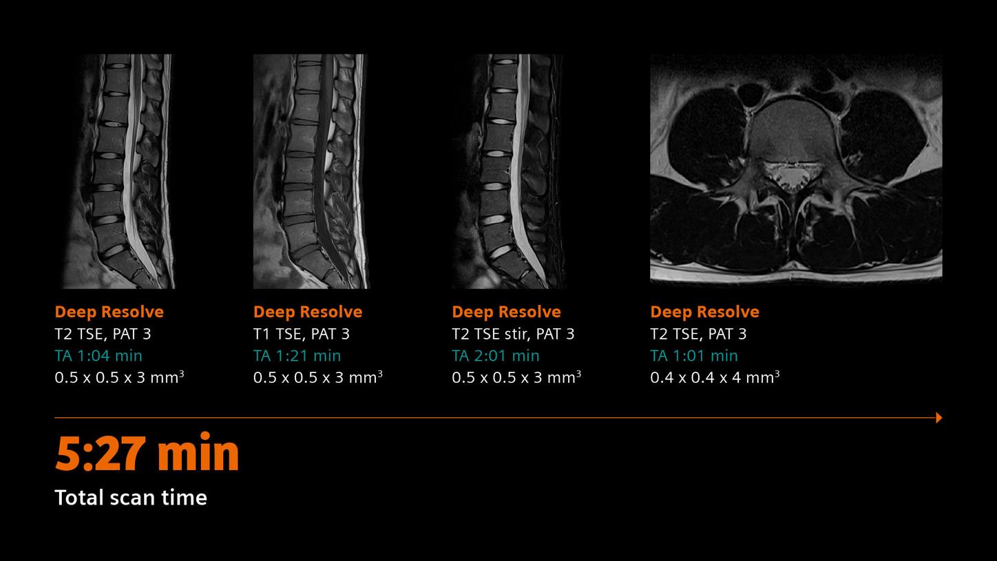 Clinical image - Spine