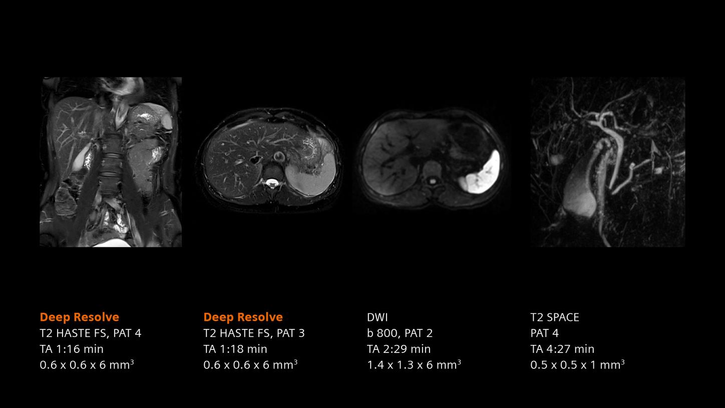 Clinical image - Liver