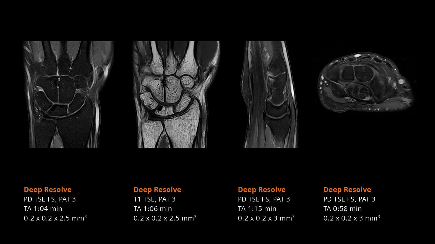 Clinical image - Wrist