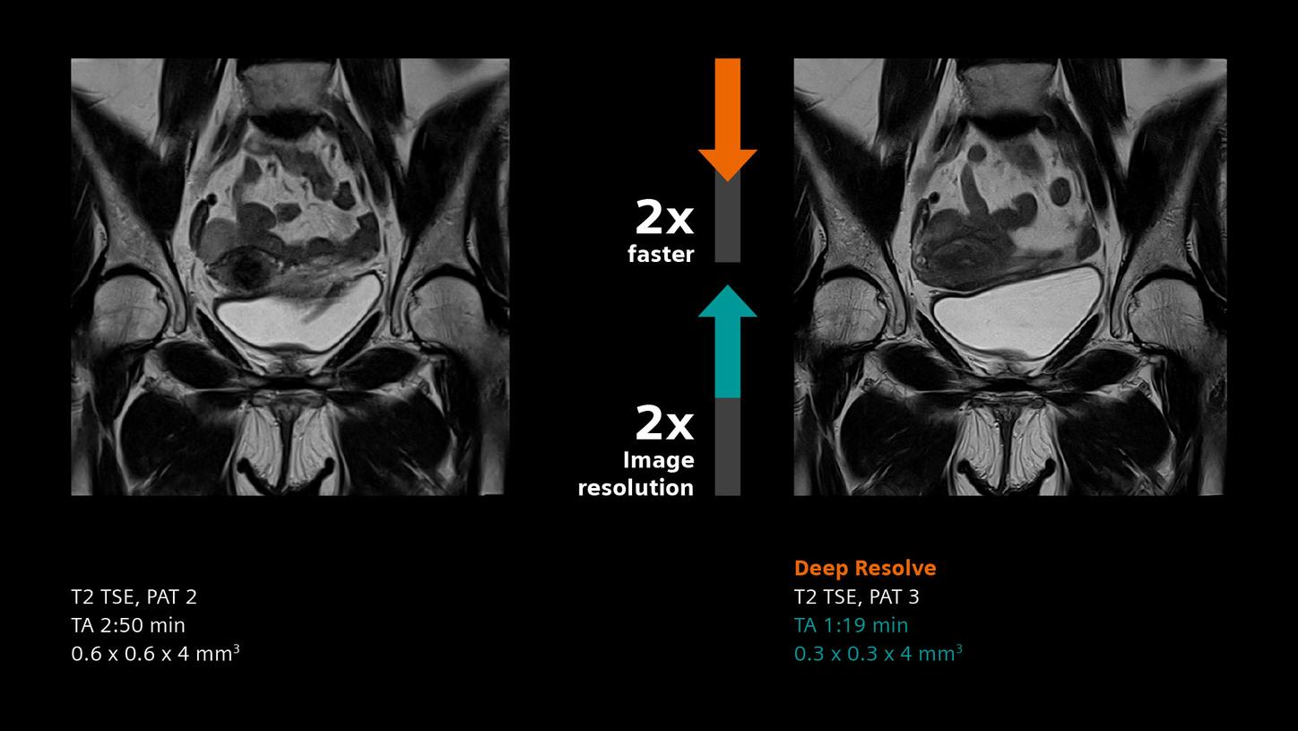Clinical image - Pelvis