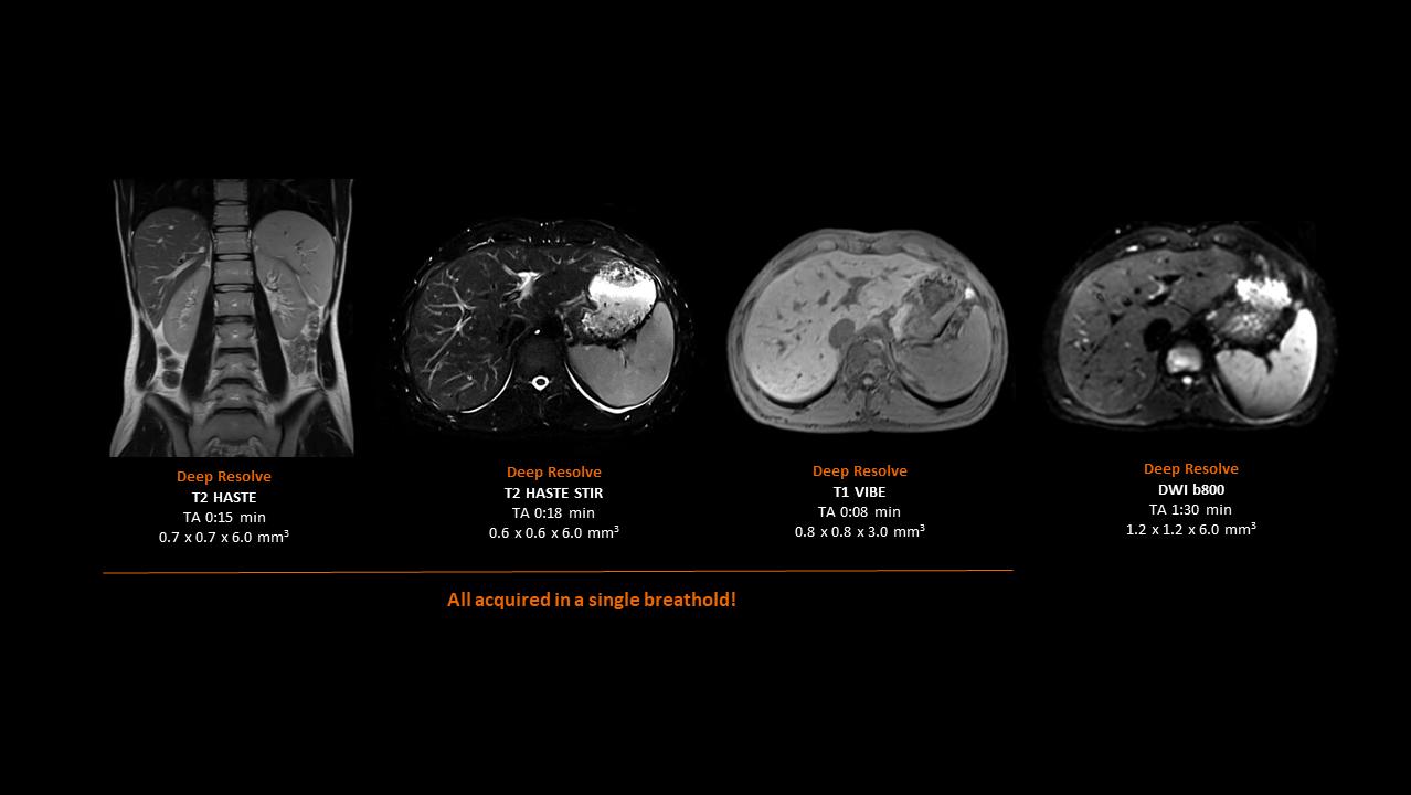Clinical image - Liver