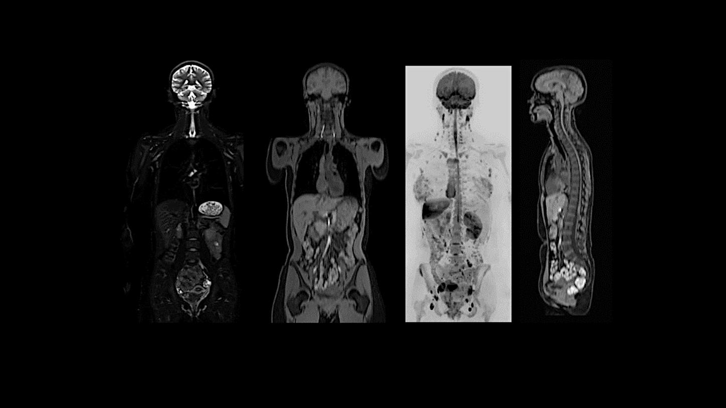 Clinical image - Whole-Body
