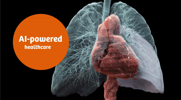 Artificial Intelligence in healthcare