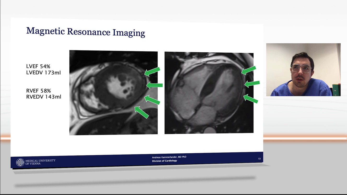 siemens healhineers acute chest pain talk kammerlander