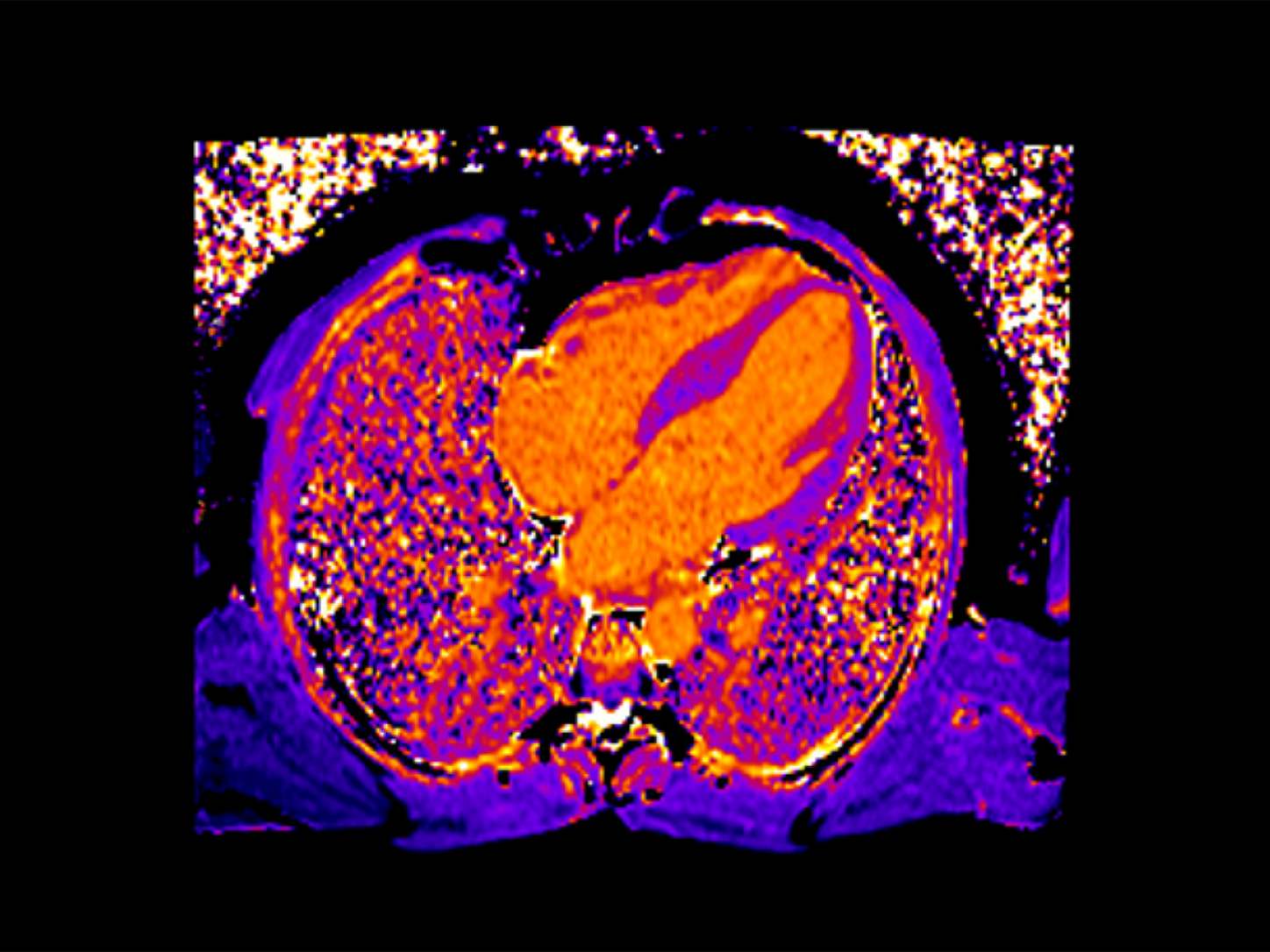 Cardiovascular MRI Efficient, reliable, ready.
