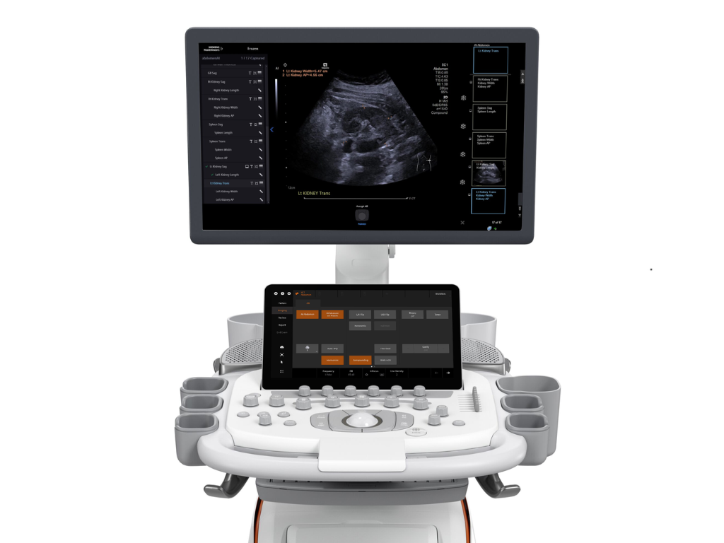 ACUSON Sequoia Ultrasound System