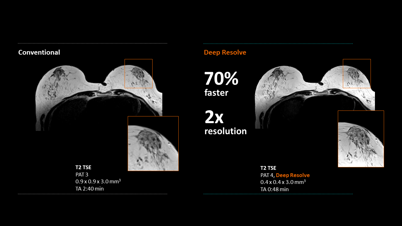 Clinical image - Breast