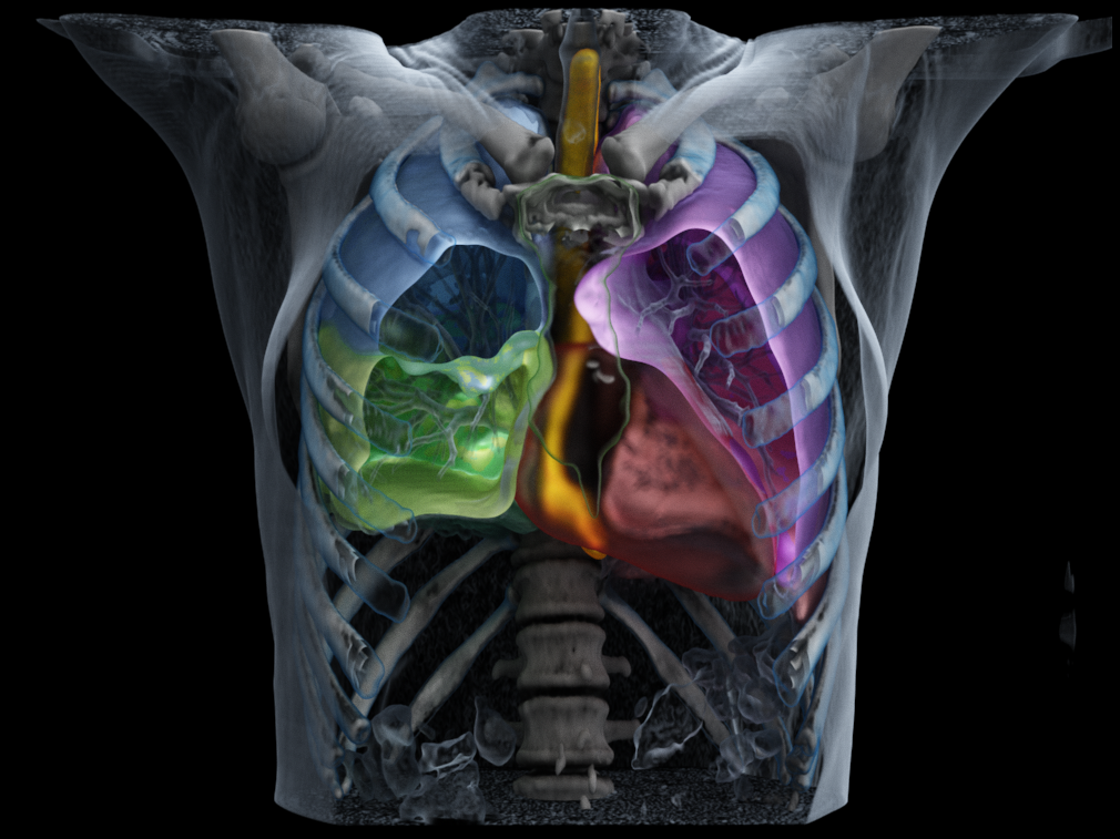 Autocontouring solutions