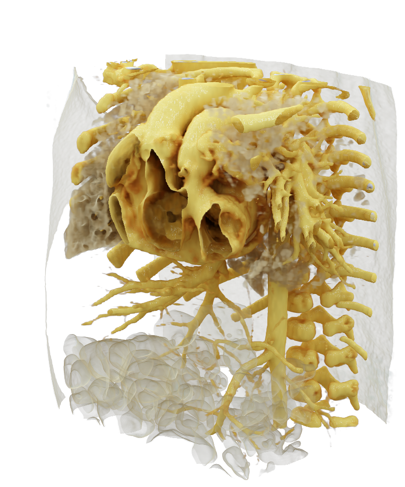 Spacial presentation of the heart in 3D
