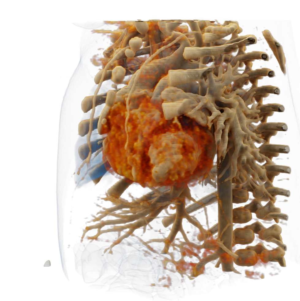 Spacial presentation of the heart in 3D