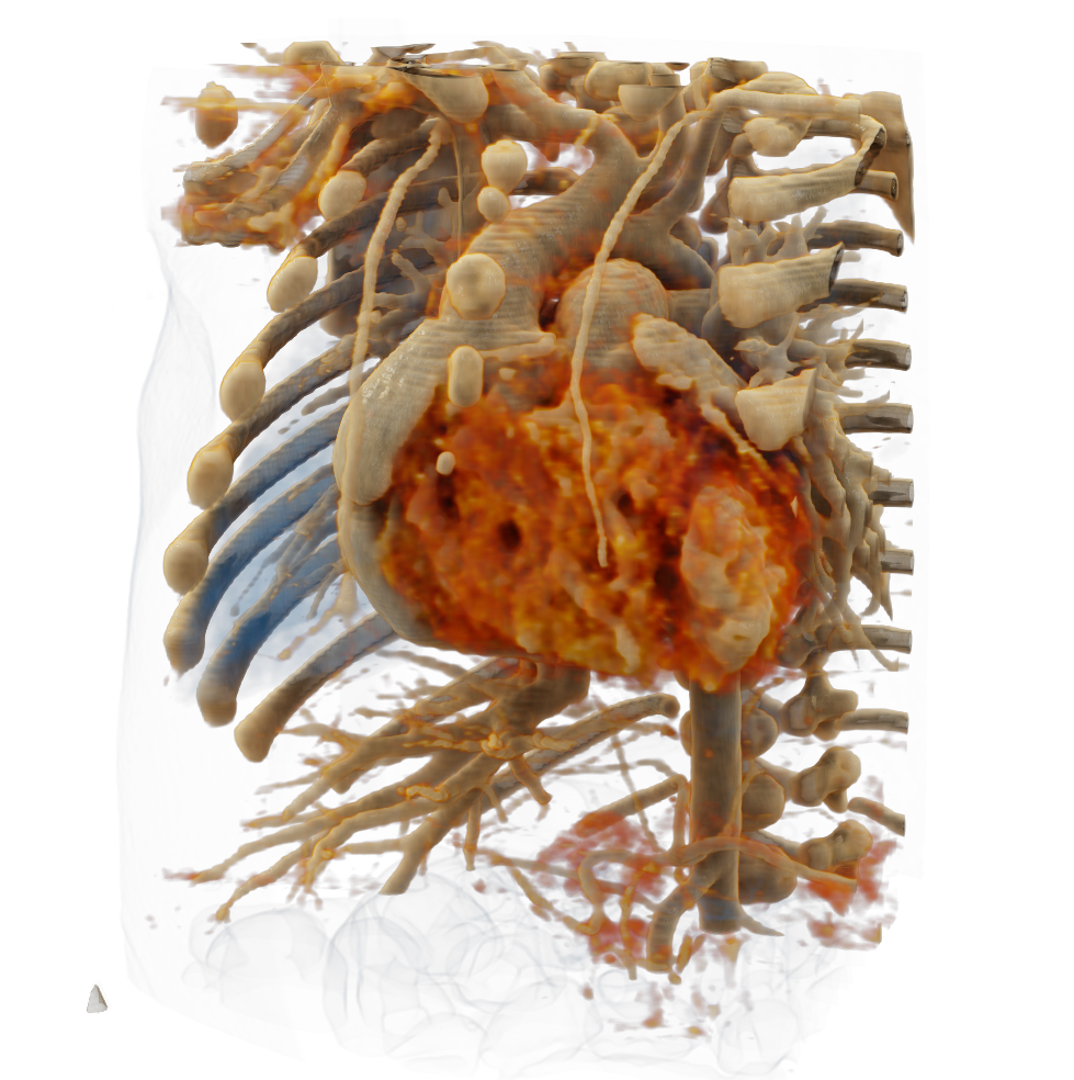Spacial presentation of the heart in 3D
